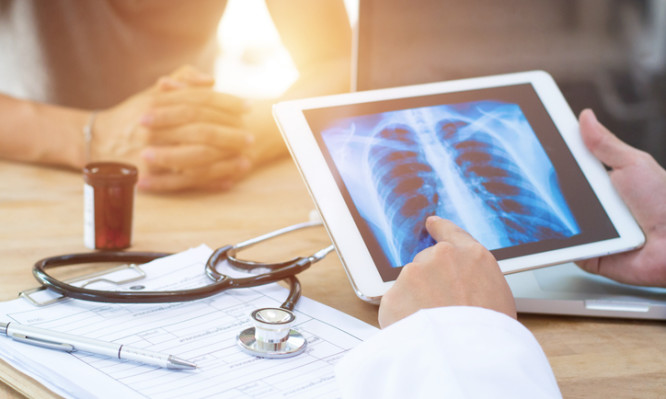 Καρκίνος του πνεύμονα: Γιατί «απειλεί» τους μη καπνιστές  - Media