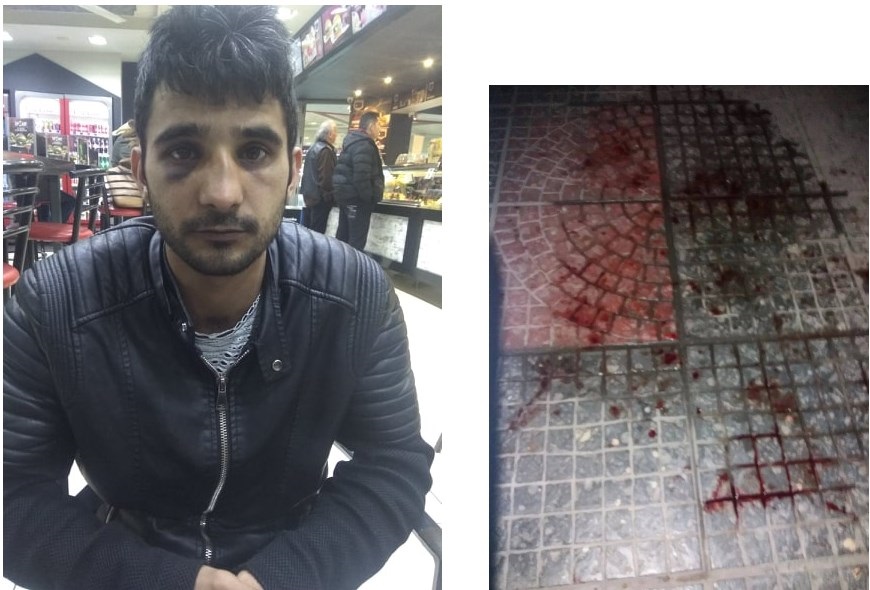 Καταγγελία: Αστυνομικοί της ΔΙΑΣ «έσπασαν στο ξύλο» μετανάστη επειδή νόμιζαν ότι έκλεψε αυτοκίνητο - Media