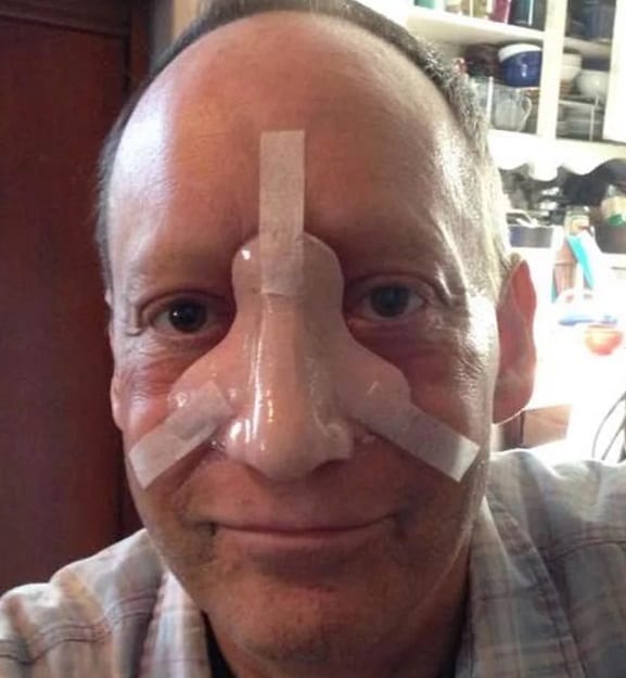 Από καρκίνο στη μύτη πέθανε στα 58 του ο ηθοποιός Steven Levy - Media