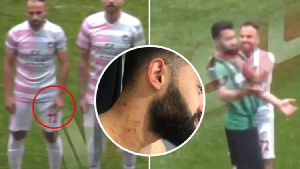 Τούρκος παίκτης χαράκωσε αντίπαλο έχοντας κρυμμένο ξυραφάκι (Video)  - Media