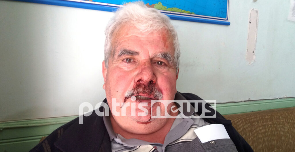 Ηλεία: Αγρότης ζήτησε τα λεφτά για τα καρπούζια του και έφαγε άγριο ξύλο (Photos) - Media