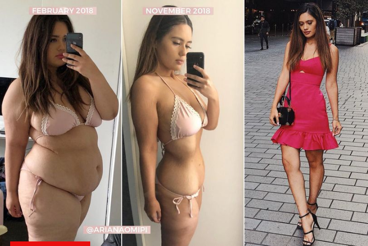 Η απίστευτη μεταμόρφωση: Έχασε 70 κιλά σε 11 μήνες και έγινε άλλη γυναίκα (Photo) - Media