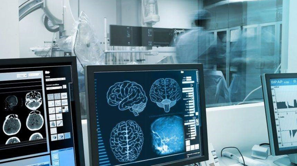 Η Ελλάδα έχει τα περισσότερα θανατηφόρα εγκεφαλικά επεισόδια - Media