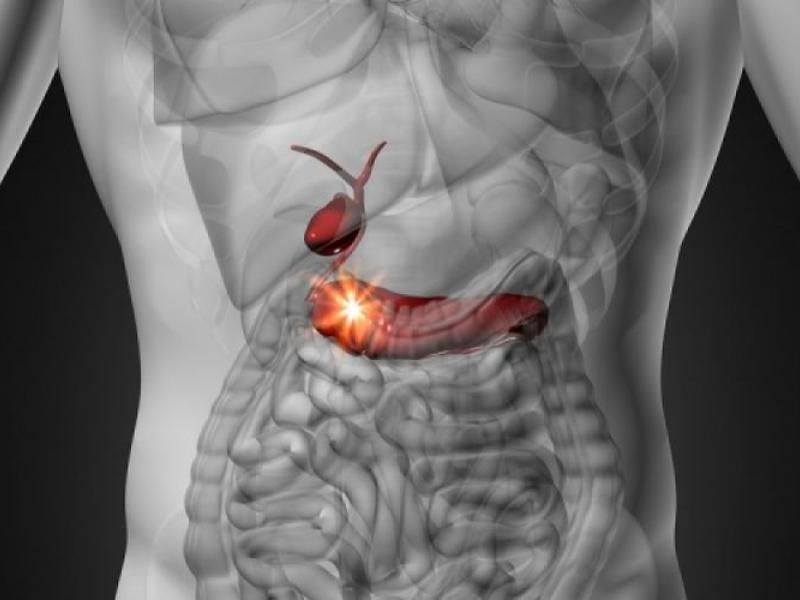 Καρκίνος Παγκρέατος: Τα επικίνδυνα συμπτώματα και οι παράγοντες κινδύνου - Media