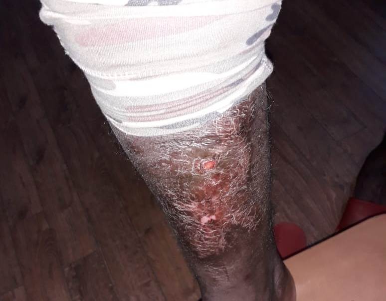 «Να πεθάνεις εδώ, όχι στο νοσοκομείο»: Άγριο ξυλοδαρμό μετανάστη από αστυνομικούς καταγγέλλει η ΚΕΕΡΦΑ - Media