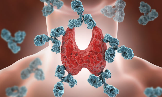 Θυρεοειδίτιδα Χασιμότο: Τι είναι, συμπτώματα και πότε πρέπει να σας δει γιατρός (Video) - Media