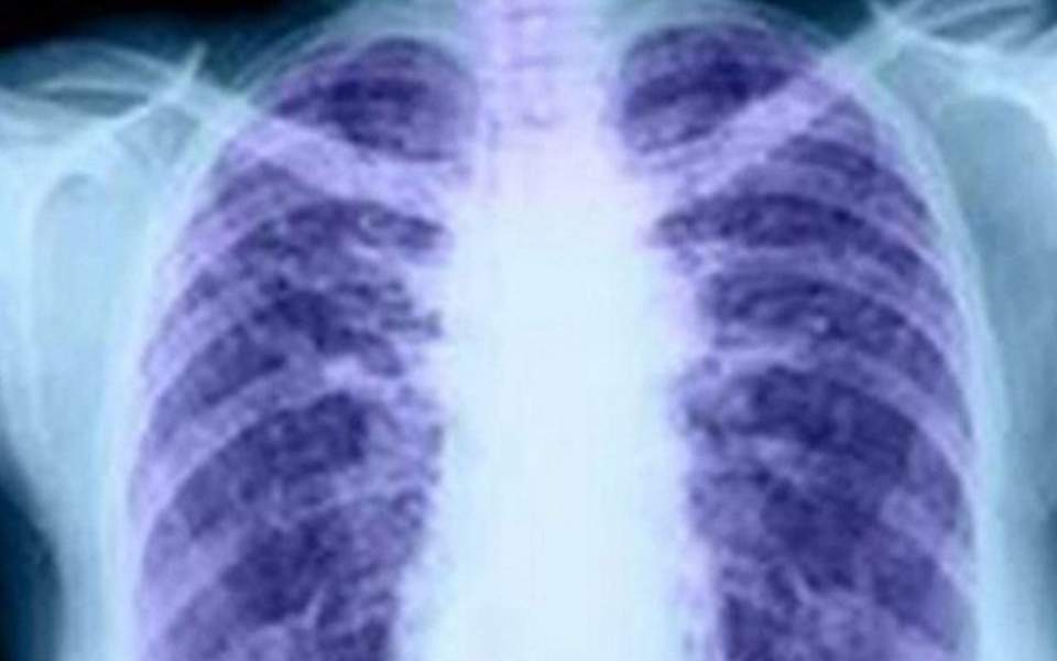 Επιστήμονες στη Γερμανία δημιούργησαν διαφανή ανθρώπινα όργανα - Media