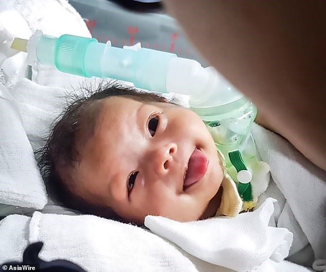 Βρέφος έβγαλε όγκο στο στόμα που του προκάλεσε παράλυση (Σκληρές Photos) - Media