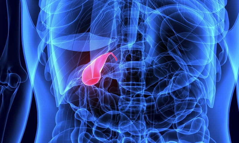 Καρκίνος στην χολή: Προσοχή στα «ύπουλα» συμπτώματα - Media