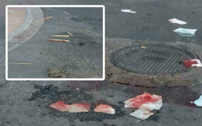 Βαρύς ξυλοδαρμός στην Κρήτη: Τον χτύπησαν με ξύλα – Μεταφέρθηκε αναίσθητος στο νοσοκομείο - Media