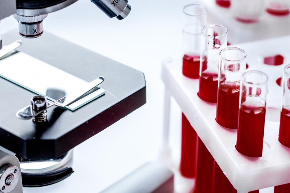 Διαγνωστικά κέντρα: Το πρωί της Τετάρτης η απόφαση για την απεργία - Media