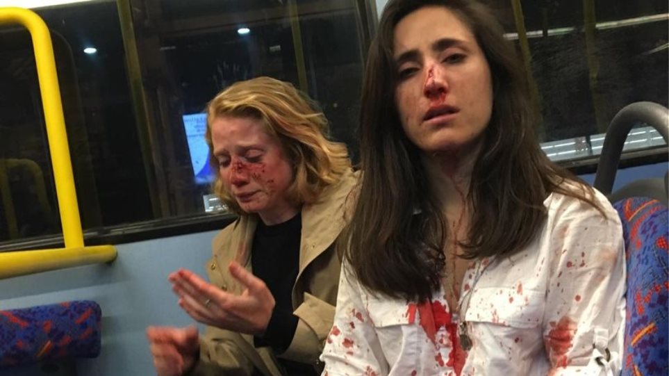 Άγρια επίθεση ανδρών σε αεροσυνοδό και την κοπέλα της - Τους ζήτησαν να φιληθούν κι εκείνες αρνήθηκαν (Photos) - Media