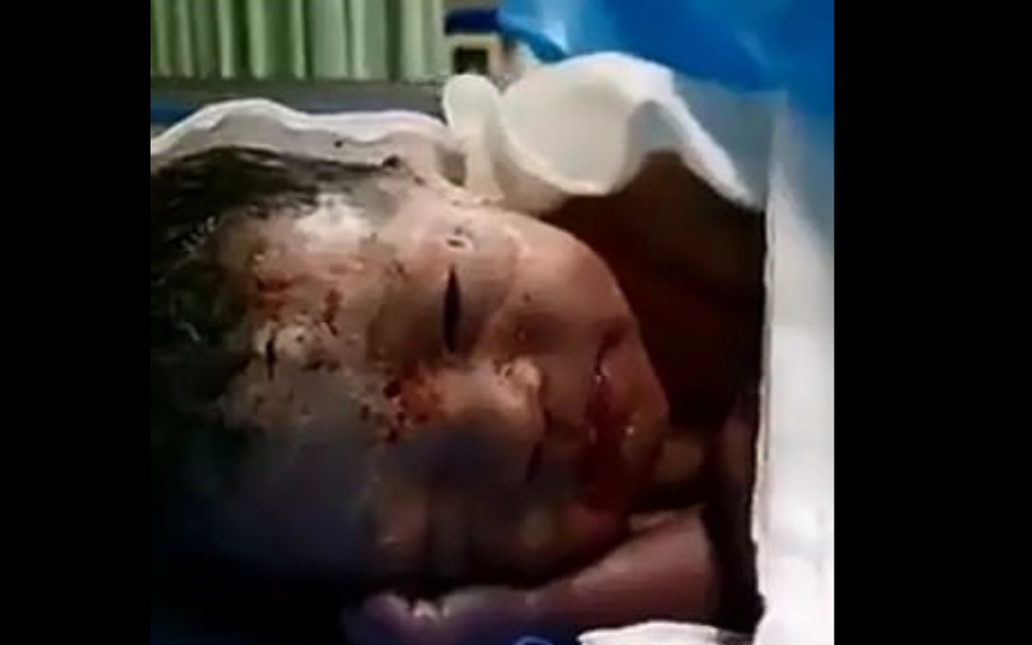 Κίνα: Πέταξαν νεογέννητο με τον πλακούντα και τον ομφάλιο λώρο σε τουαλέτα (Σκληρές εικόνες) - Media