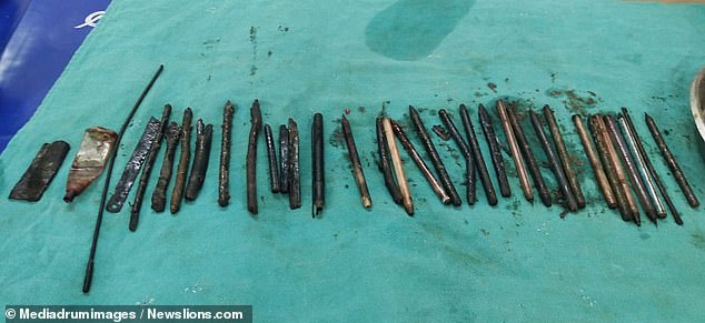 Αφαίρεσαν από το στομάχι άνδρα 33 αντικείμενα ανάμεσα στα οποία, ξυράφια και… κατσαβίδι (Photos/Video) - Media