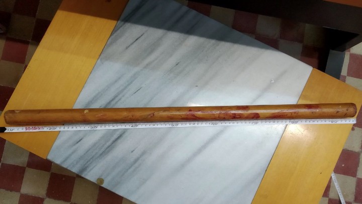 Άγριο ξύλο στη Ρόδο: Επέστρεψαν με γκλοπ, ρόπαλο και πτυσσόμενο μαχαίρι – Νεκρός 37χρονος - Media