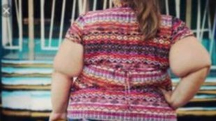 Η παχυσαρκία συνδέεται με μειωμένη ανταπόκριση στη γεύση - Media