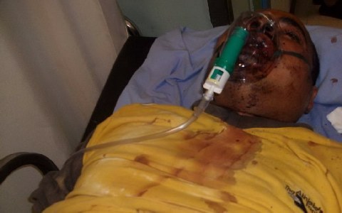 Στην γραμμή «δεν είδα, δεν άκουσα» οι απολογούμενοι χρυσαυγίτες για την επίθεση στους αλιεργάτες - Media