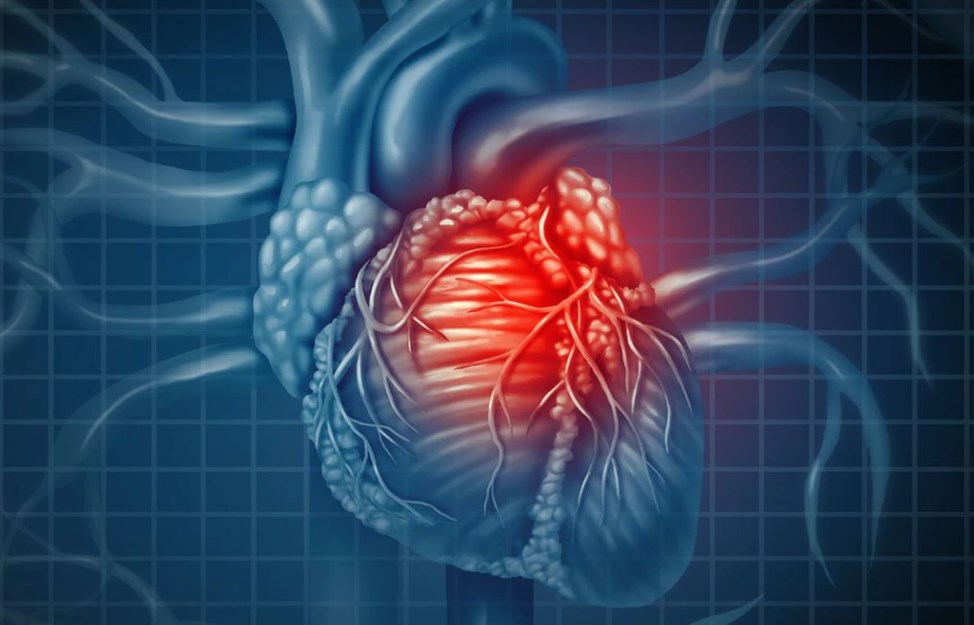 Ανεύρυσμα αορτής: Πότε μπορεί να αποβεί μοιραίο - Media