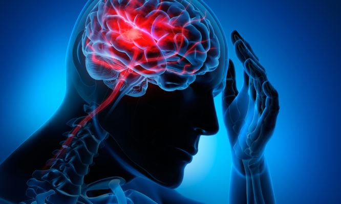 Εγκεφαλικό: Προσοχή στα πρώιμα συμπτώματα - Ποιοι κινδυνεύουν περισσότερο - Media