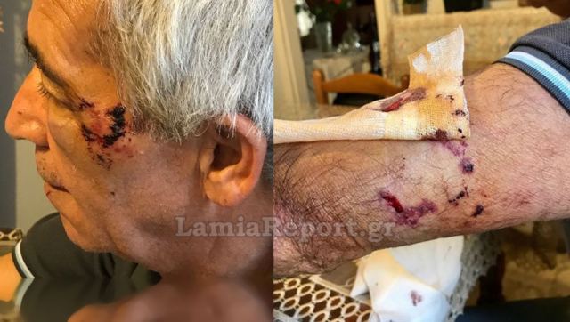 Λαμία: Άγρια επίθεση από σκύλο δέχτηκε άνδρας (Photos) - Media