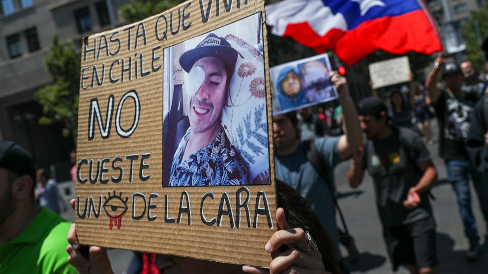 Χιλή: Συγκέντρωση πολιτών με οφθαλμικά τραύματα από αστυνομικά πυρά μπροστά στο προεδρικό μέγαρο (Photos/Video) - Media
