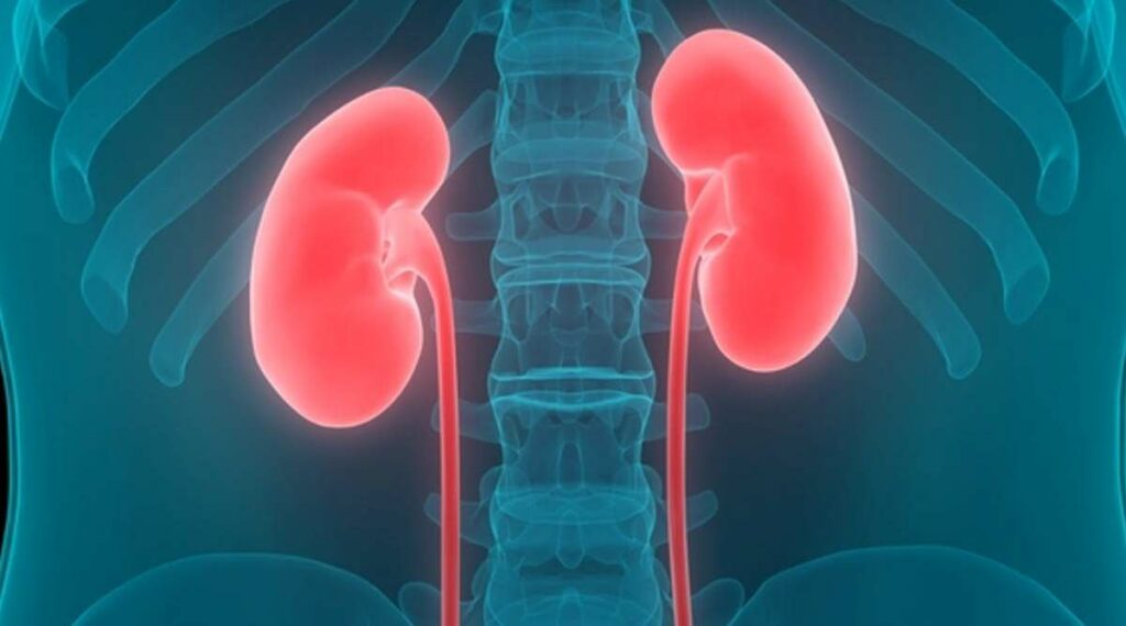 Νεφρό-τέρας: Αφαίρεσαν όργανο βάρους... 7,5 κιλών (Photo) - Media