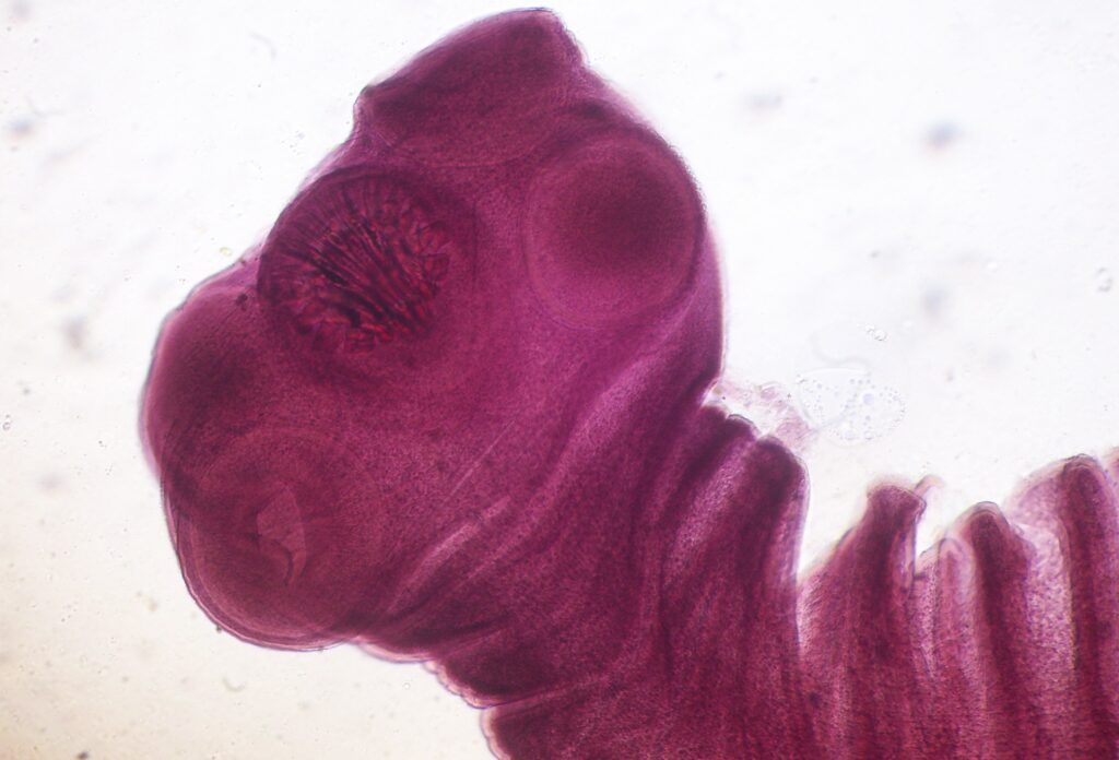 Εφιάλτης: Έφαγε κακομαγειρεμένο χοιρινό και γέμισε σκουλήκια στον εγκέφαλο - Media