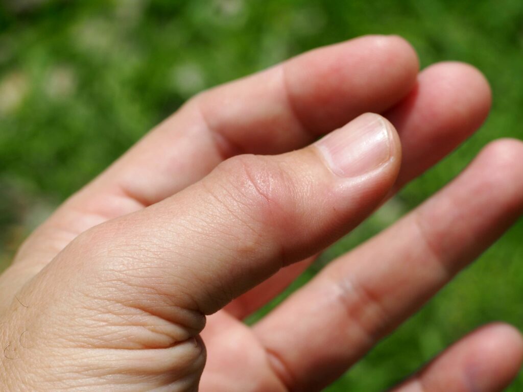 Μούδιασμα στα δάχτυλα: Ποιες σοβαρές παθήσεις μπορεί να κρύβει - Media