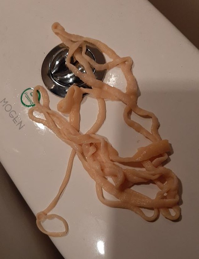 Πήγε στην τουαλέτα συνειδητοποίησε ότι είχε σκουλήκι στο έντερο του  (Photos/Video) - Media