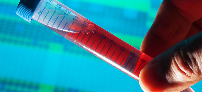 Λεμφοπενία: Η «νόσος» στο αίμα που απειλεί με πρόωρο θάνατο  - Media