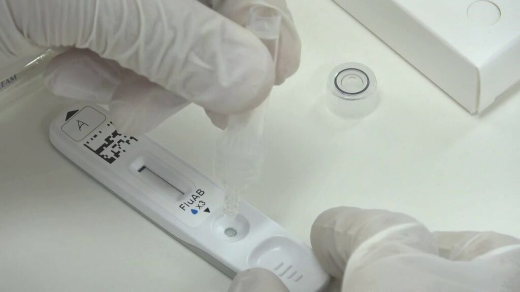 Έξαρση της γρίπης στην Ελλάδα: 8 νεκροί - Πότε κάνουμε τεστ για να δούμε αν νοσούμε - Media