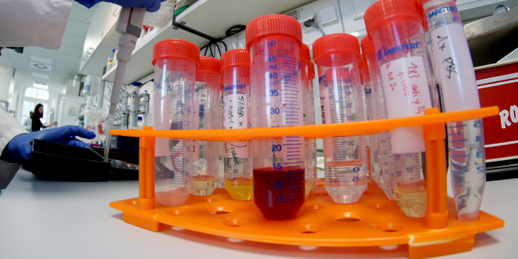 Κορωνοϊός: Ο αριθμός των κρουσμάτων αυξήθηκε κατά 2.186 στη Ρωσία  - Media