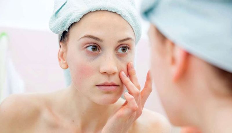 Μαύροι κύκλοι: Τρόποι αντιμετώπισης  - Media