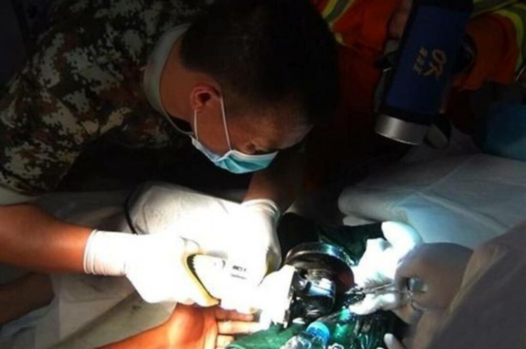 Έβαλε το πέος του σε σωλήνα και… σάπισε!  - Media