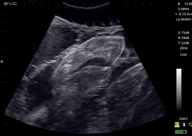 Εκπληκτικό βίντεο: Υπερηχογράφημα σε έγκυο καρχαρία δείχνει το μωρό καρχαριάκι στην κοιλιά της (Photos/Video)  - Media