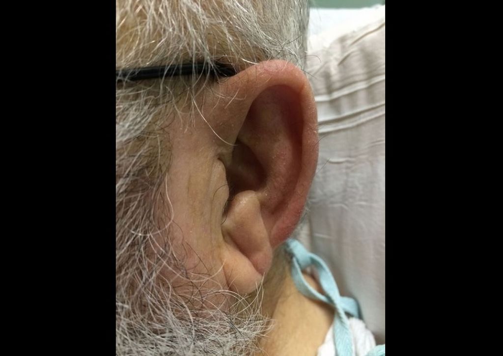 Κορονoϊός: Σε καραντίνα για 14 μέρες οι δύο Έλληνες που επέστρεψαν από την Κίνα - Media