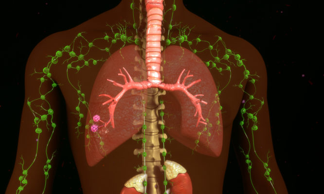 Πως γίνεται η πρόληψη στο λεμφικό σύστημα και πώς η αποτοξίνωση στους λεμφαδένες - Media