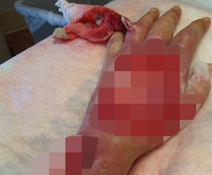 Ένα απλό κόψιμο από χαρτί, λίγο έλειψε να της στοιχήσει τη ζωή (Photos) - Media