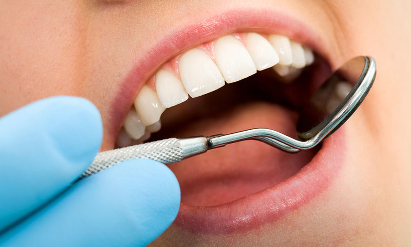 Προσοχή: Αυτή η πάθηση τον δοντιών αυξάνει τον κίνδυνο για εγκεφαλικό  - Media