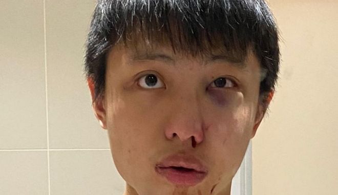 Λονδίνο: Του είπε «δεν θέλω τον κορωνοϊό σου» και τον σάπισε στο ξύλο - Media