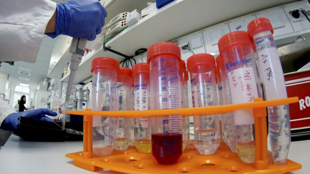 Γαλλία-Γερμανία μελετούν φάρμακα κατά της ελονοσίας για την καταπολέμηση του κορωνοϊού - Media