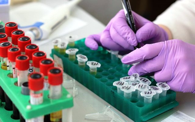 Κορωνοϊός: Η Ισπανία αμφισβητεί την κινεζική τεχνογνωσία - Ανακριβή τα πολυδιαφημισμένα ταχέα διαγνωστικά τεστ - Media