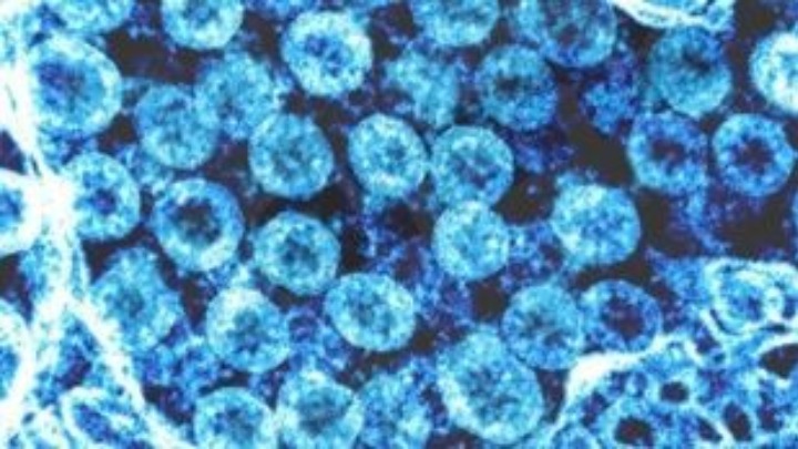 Κορονοϊός: Το Ισραήλ ανακοίνωσε τον πρώτο νεκρό από την πανδημία - Media