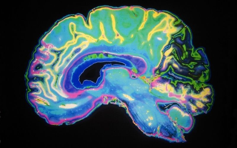 Τι συμβαίνει στον εγκέφαλο ενός ατόμου με κατάθλιψη (Video) - Media
