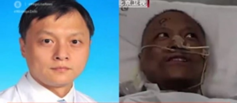 Απίστευτη επιπλοκή: Μαύρισε το δέρμα δύο Κινέζων γιατρών που προσβλήθηκαν από κορωνοϊό (Video) - Media