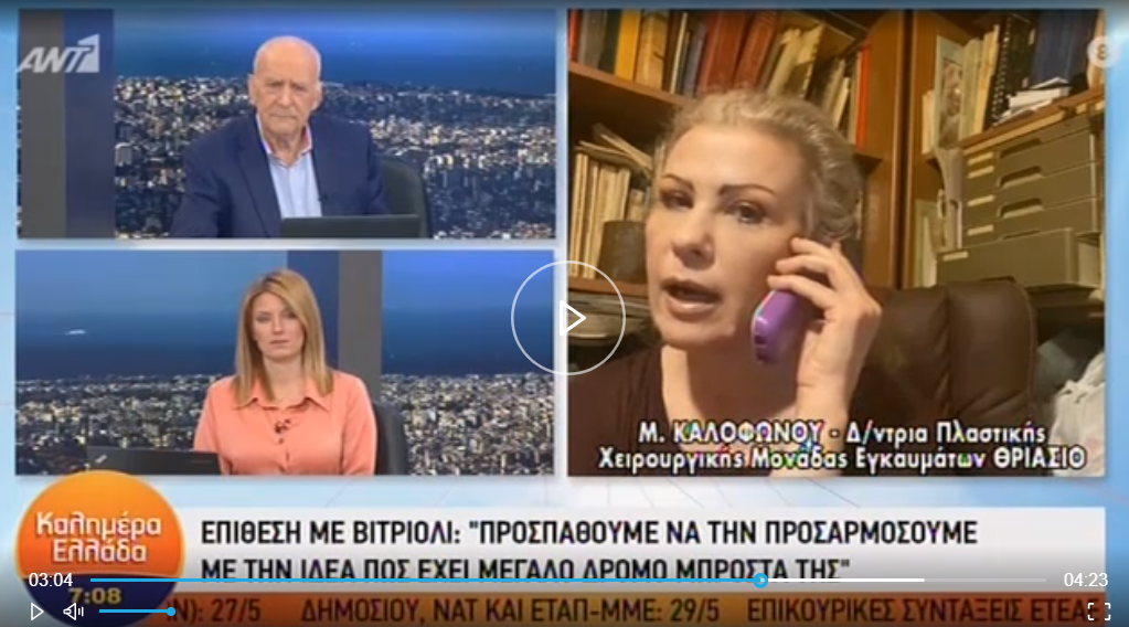 Πλαστική χειρουργός για 34χρονη Ιωάννα: «Έχει ολικού πάχους εγκαύματα, έχει πολύ δρόμο μπροστά της» (Video) - Media