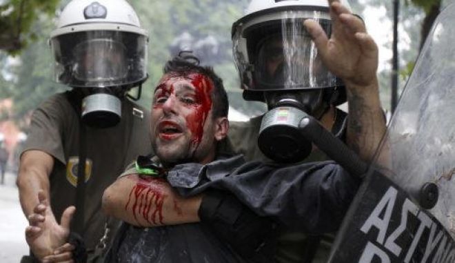 Μανώλης Κυπραίος: Δικαιώθηκε ο ρεπόρτερ που ξυλοκοπήθηκε και έχασε την ακοή του από κρότου-λάμψης (Photos) - Media