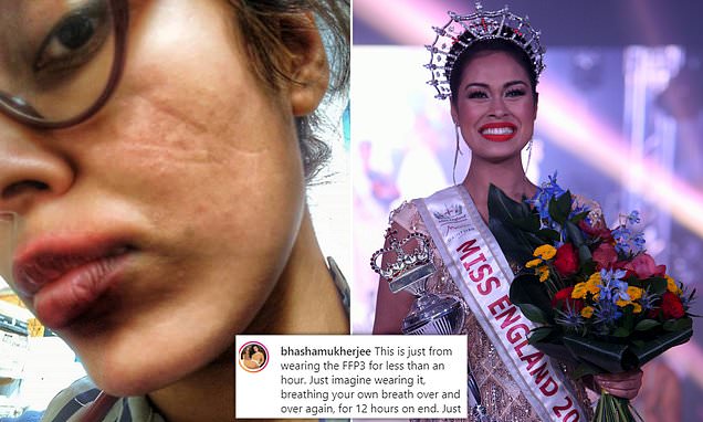 Η Μις Αγγλία, παράτησε το μόντελινγκ και επέστρεψε στα νοσοκομεία αφού είναι γιατρός, για να βοηθήσει στη μάχη κατά του κορωνοϊου – Χαρακώθηκε το πρόσωπο της από τη μάσκα - Media