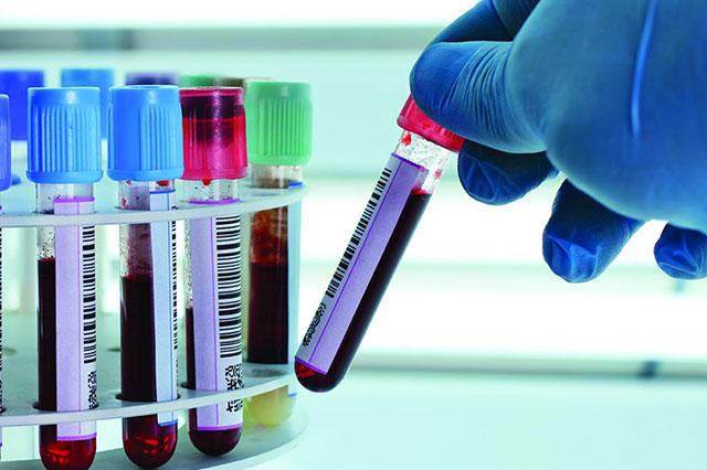 «Ο κορωνοϊός κατασκευάστηκε σε εργαστήριο» πιστεύουν οι μισοί Έλληνες (Photos) - Media