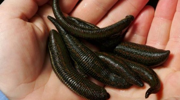 Βδέλλα μπήκε μέσα στο πέος άντρα: Του ρούφηξε πάνω από μισό λίτρο αίμα (Photos) - Media